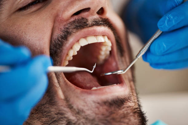 Best Emergency Treatment for Dental Infections or Abscesses in Bath, MI